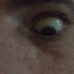 Meet your Posher, Brock